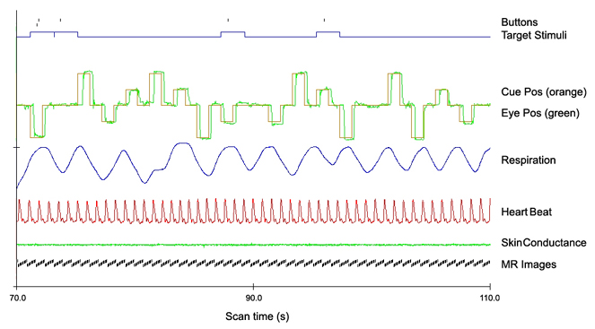 Example of multi-channel time course data recorded by CIGAL during a fMRI scan